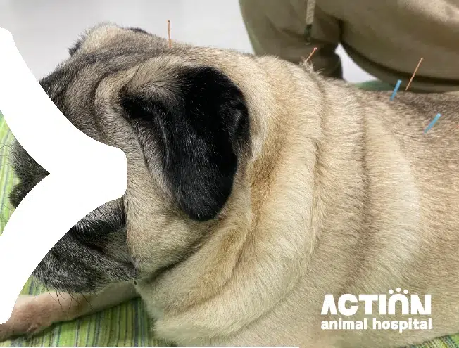 ACTION HOME V2 ACUPUNCTURE